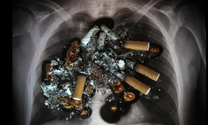[Infographic] Khiếp đảm tác hại của thuốc lá trên cơ thể con người
