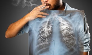 [Infographic] Thuốc lá là nguyên nhân hàng đầu gây bệnh tim mạch